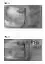 Fig. 04 - Dilution control in hardfacing severe service components