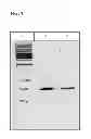 Fig. 02 - Method for the synthesis of chiral cyanohydrins via a hydroxynitrile lyase from brassicaceae