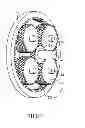Fig. 02 - APPARATUS FOR ELIMINATING BACKLASH IN A PLANETARY GEAR SET