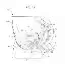 Fig. 02 - APPARATUS AND METHOD FOR THE TREATMENT OF ABNORMAL UTERINE BLEEDING