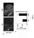 Fig. 09 - Improving efficacy of cancer therapy