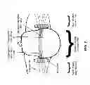 Fig. 09 - Modulating function of neural structures near the ear