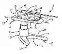 Fig. 01 - INFANT TRANSPORTER APPARATUS