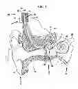 Fig. 02 - Implantable component of a hearing prosthesis