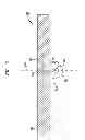 Fig. 06 - Implantable component of a hearing prosthesis