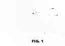 Fig. 02 - Intra-nasal aromatherapy clip