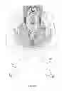 Fig. 22 - Bodily implants and methods for delivery and placement of bodily implants into a patients body