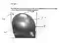 Fig. 02 - System and Method for Detecting, Recording, and Treating Persons with Traumatic Brain Injury