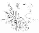 Fig. 01 - Intrajugular catheter and method