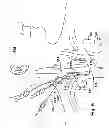 Fig. 06 - Intrajugular catheter and method