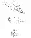 Fig. 02 - Microvascular obstruction detection and therapy
