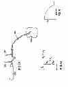 Fig. 03 - Microvascular obstruction detection and therapy