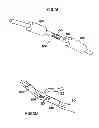 Fig. 05 - Microvascular obstruction detection and therapy