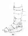 Fig. 02 - Systems, devices, and methods for providing foot loading feedback to patients and physicians during a period of partial weight bearing