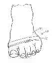 Fig. 01 - SYSTEM AND METHOD USING A SENSORY FOOT BAND TO IMPROVE BALANCE AND FUNCTION