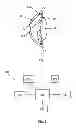 Fig. 02 - Glaucoma drainage devices including vario-stable valves and associated systems and methods