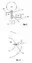 Fig. 03 - Glaucoma drainage devices including vario-stable valves and associated systems and methods