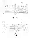 Fig. 09 - Glaucoma drainage devices including vario-stable valves and associated systems and methods