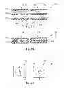 Fig. 13 - Glaucoma drainage devices including vario-stable valves and associated systems and methods