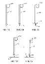 Fig. 02 - Apparatus and methods for hybrid endoscopic and laparoscopic surgery