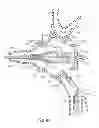 Fig. 08 - SURGICAL INSTRUMENT