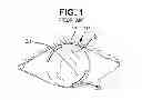 Fig. 02 - Method and apparatus for making improved surgical incisions in corrective eye surgery