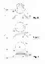Fig. 09 - Device for processing eye tissue by means of a pulsed laser beam