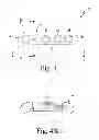 Fig. 04 - Metatarsal fixation device, system and method