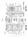 Fig. 09 - Multiple pathways for spinal nerve root decompression from a single access point