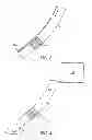 Fig. 04 - Apparatus and methods for hybrid endoscopic and laparoscopic surgery