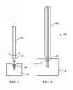 Fig. 07 - Apparatus and methods for hybrid endoscopic and laparoscopic surgery