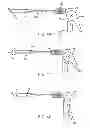 Fig. 28 - Apparatus and methods for hybrid endoscopic and laparoscopic surgery