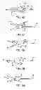 Fig. 32 - Apparatus and methods for hybrid endoscopic and laparoscopic surgery
