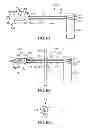 Fig. 33 - Apparatus and methods for hybrid endoscopic and laparoscopic surgery