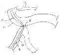 Fig. 01 - Methods and devices for endoscopically creating an anastomosis