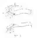 Fig. 02 - Methods and devices for endoscopically creating an anastomosis