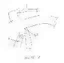 Fig. 07 - Methods and devices for endoscopically creating an anastomosis