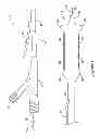 Fig. 02 - Subintimal recanalization with bio-absorbable stent