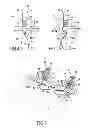 Fig. 03 - Anchor for attachment to a bony structure