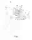 Fig. 05 - Anchor for attachment to a bony structure