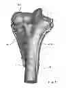 Fig. 08 - Bone plate with two different sizes of discrete drill guides connected to the plate