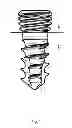 Fig. 02 - BLOCKED BONE PLATE AND SCREW PROVIDED WITH A THREADED CONIC OR PARABOLIC HEAD AND ARRANGEMENT COMPRISING AN IMPLANT AND RESPECTIVE INSERTION METHOD OF SAID IMPLANT TO A BONE TISSUE