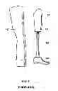 Fig. 02 - PROSTHETIC LIMB