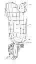Fig. 01 - Prosthesis