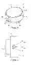 Fig. 04 - Prosthesis