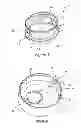 Fig. 05 - Prosthesis