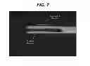 Fig. 08 - X-ray microscopy for characterizing hole shape and dimensions in surgical needles