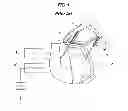 Fig. 02 - APPARATUS AND METHOD OF SETTING MAXIMUM OPENING ANGLE OF POWER TAIL GATE