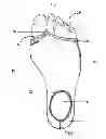 Fig. 02 - Performance enhanced water sock