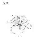 Fig. 35 - Automatic head care apparatus and automatic head washing apparatus